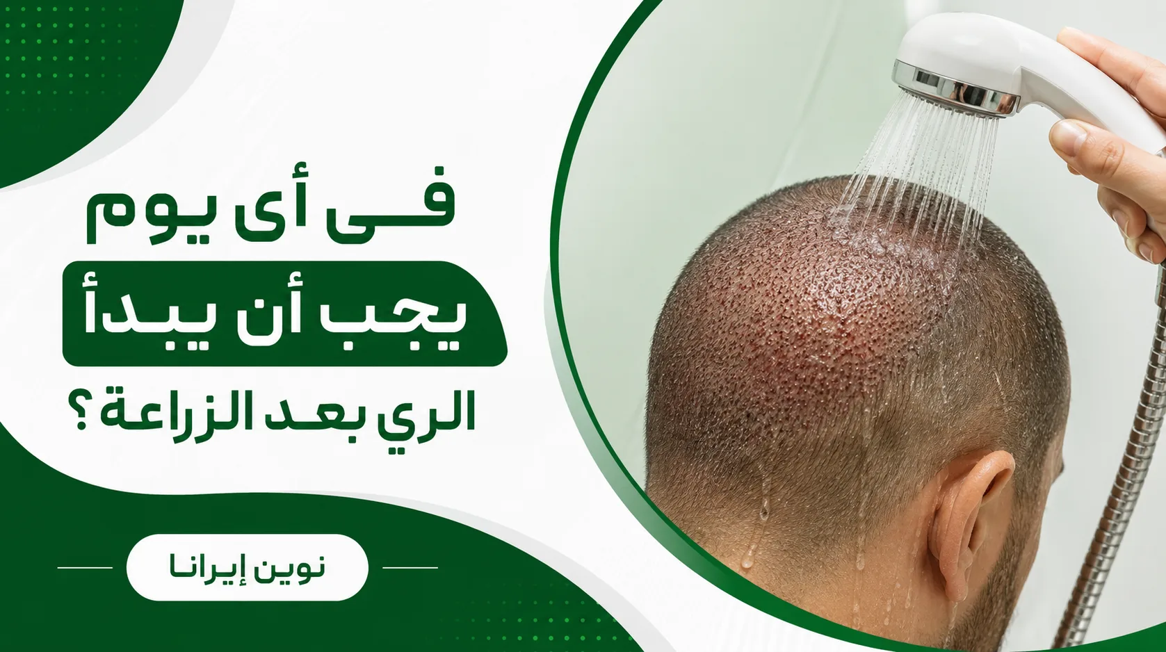 في أي يوم يجب أن يبدأ الري بعد الزراعة؟